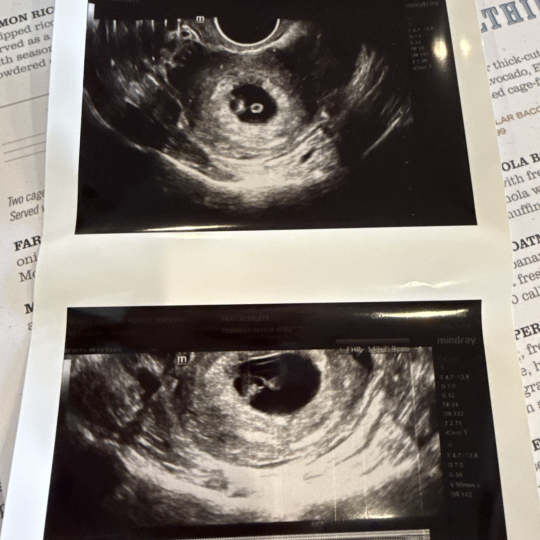 Photo shared by Scarlett for their Babylist baby registry.