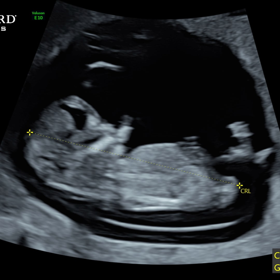 Photo shared by Tessa for their Babylist baby registry.