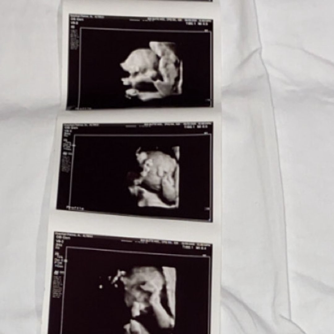 Photo shared by Angel for their Babylist baby registry.