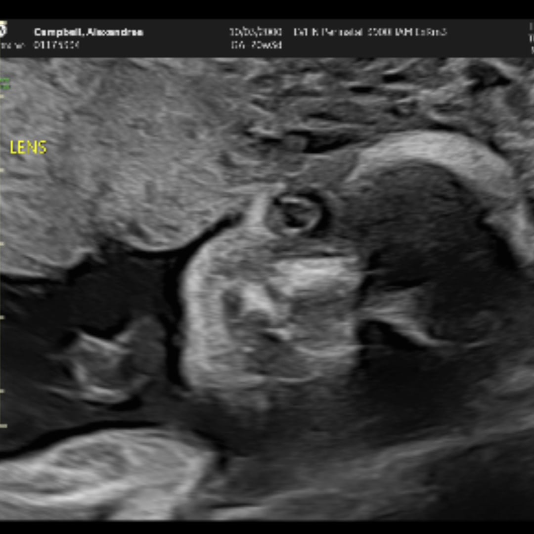 Photo shared by Ally for their Babylist baby registry.