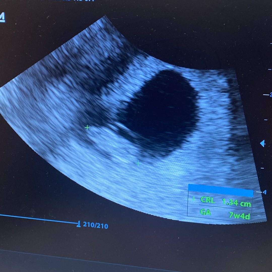 Photo shared by Michaela for their Babylist baby registry.