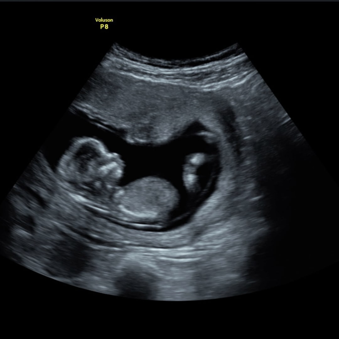 Photo shared by Harley for their Babylist baby registry.