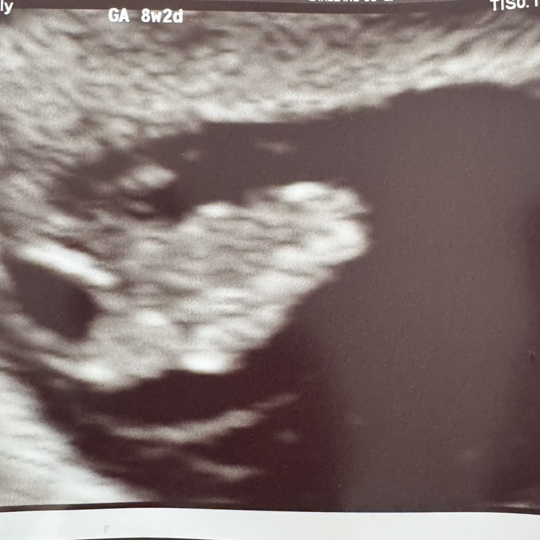 Photo shared by Kati for their Babylist baby registry.