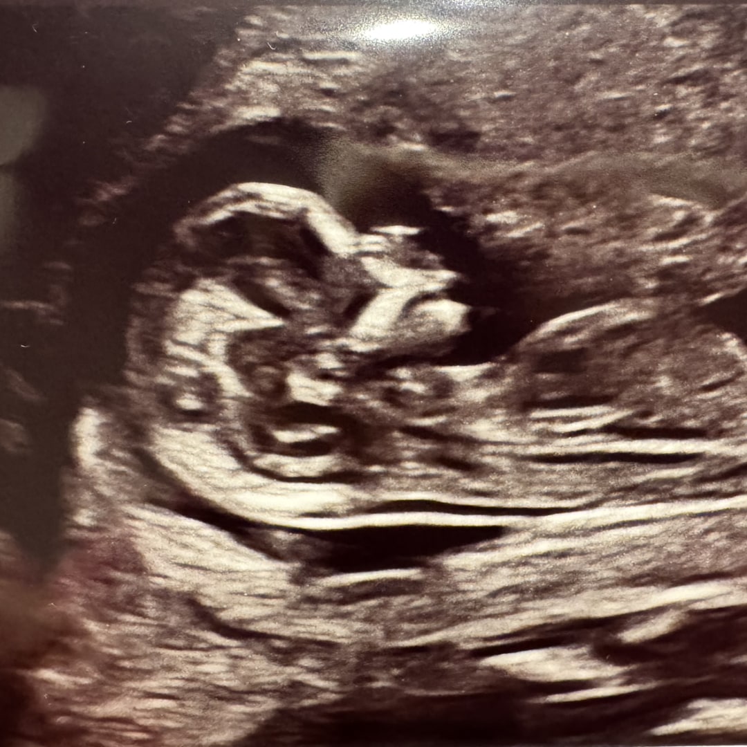 Photo shared by Mangie for their Babylist baby registry.