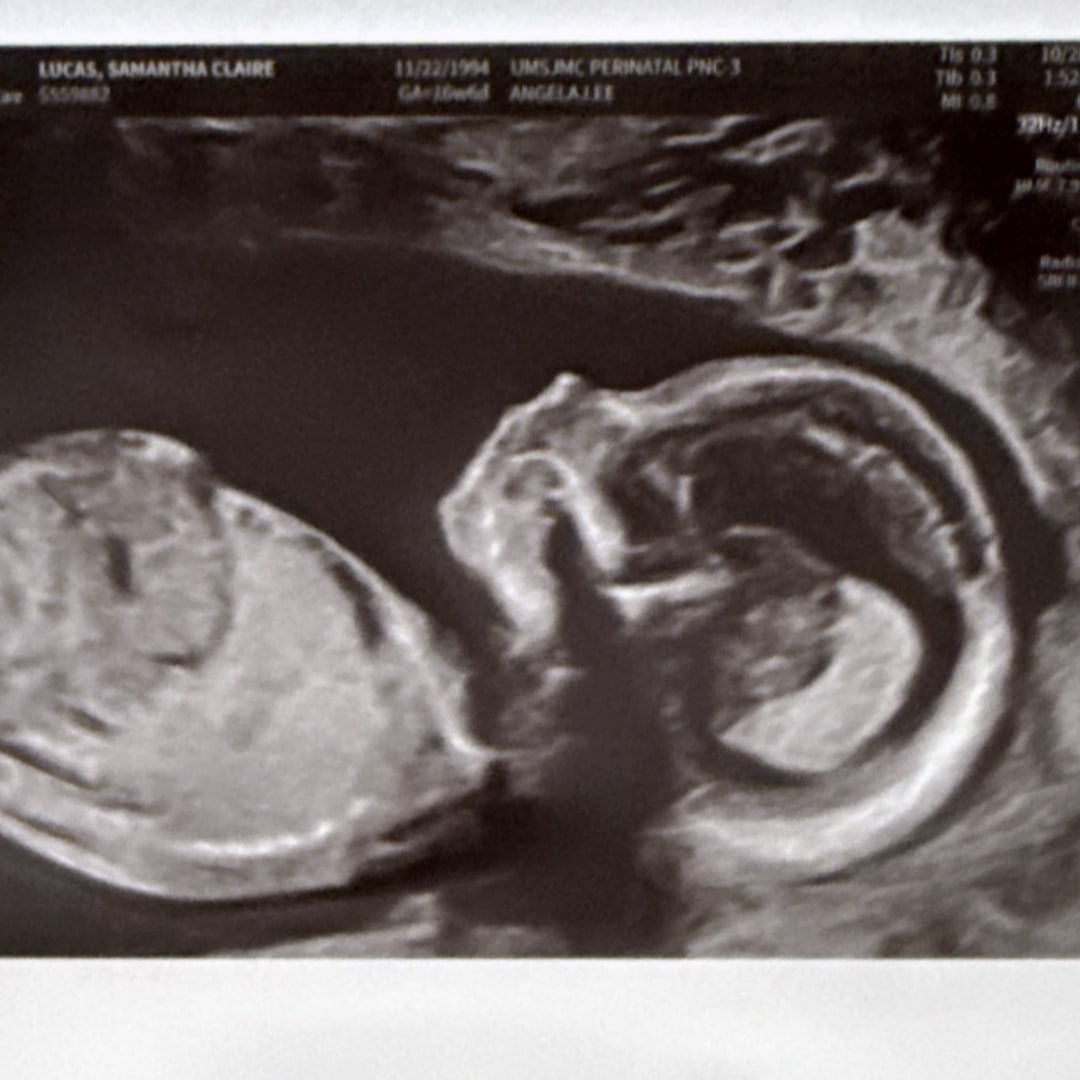 Photo shared by Samantha for their Babylist baby registry.