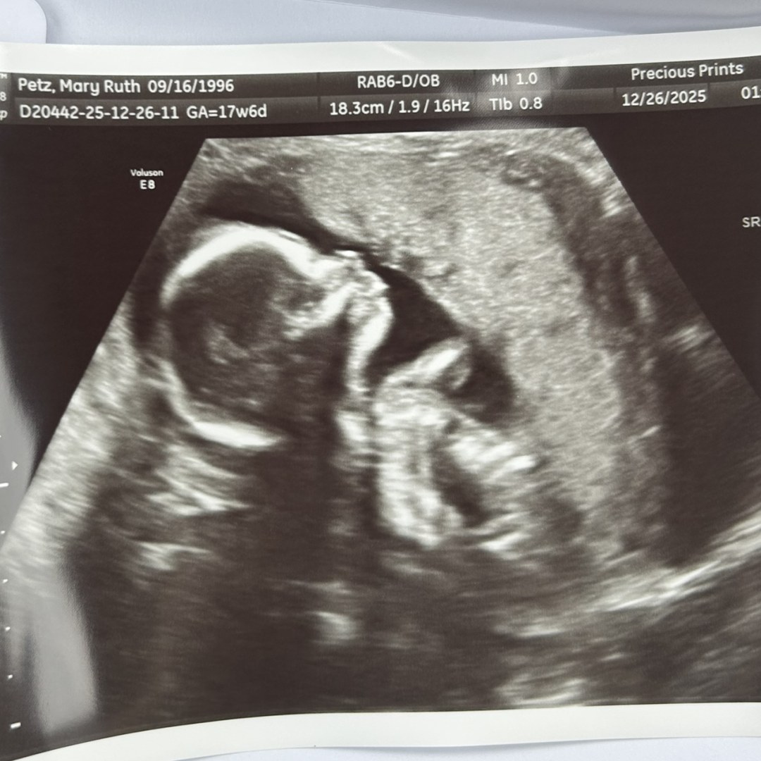 Photo shared by Mary Ruth for their Babylist baby registry.