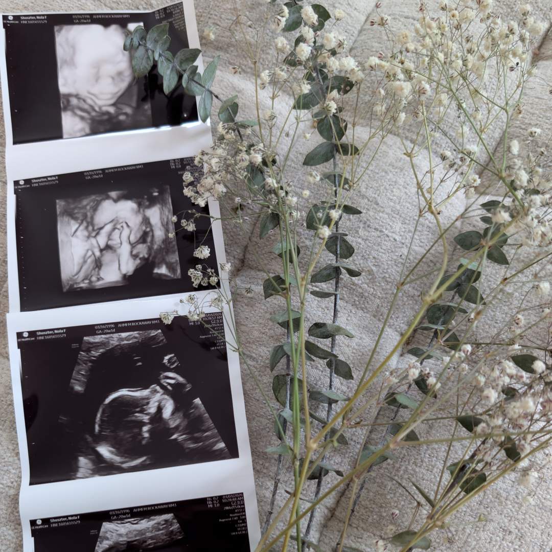 Photo shared by Nola for their Babylist baby registry.