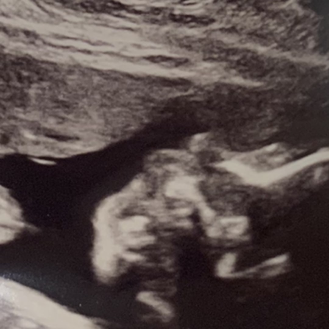 Photo shared by Abigail for their Babylist baby registry.