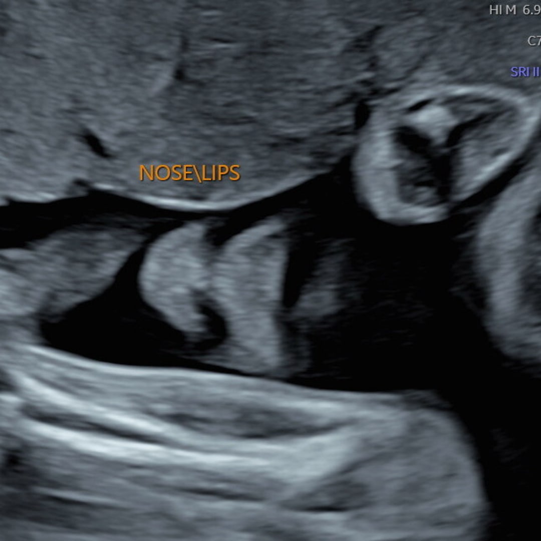 Photo shared by ✨ for their Babylist baby registry.