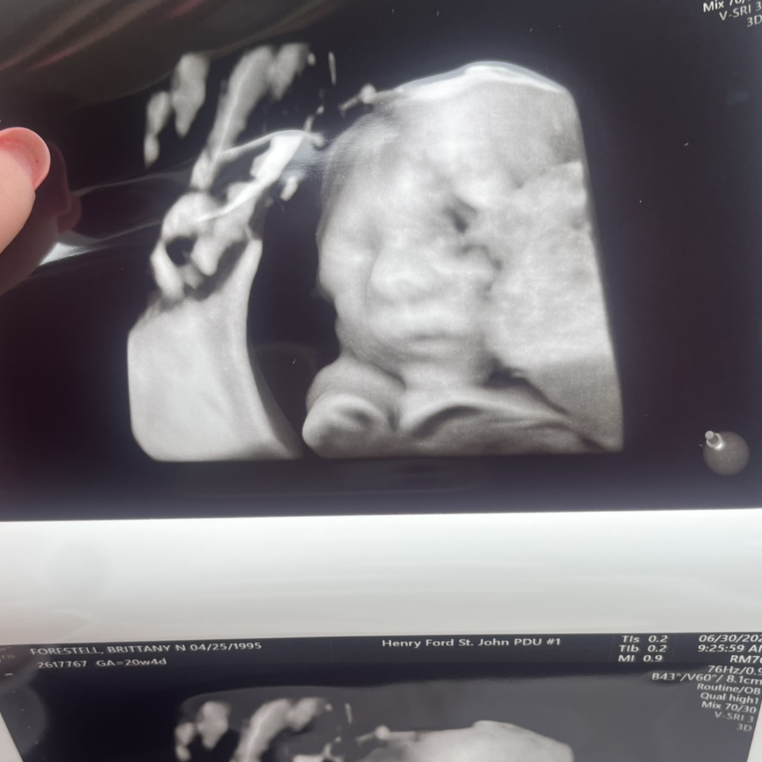 Photo shared by Brittany for their Babylist baby registry.