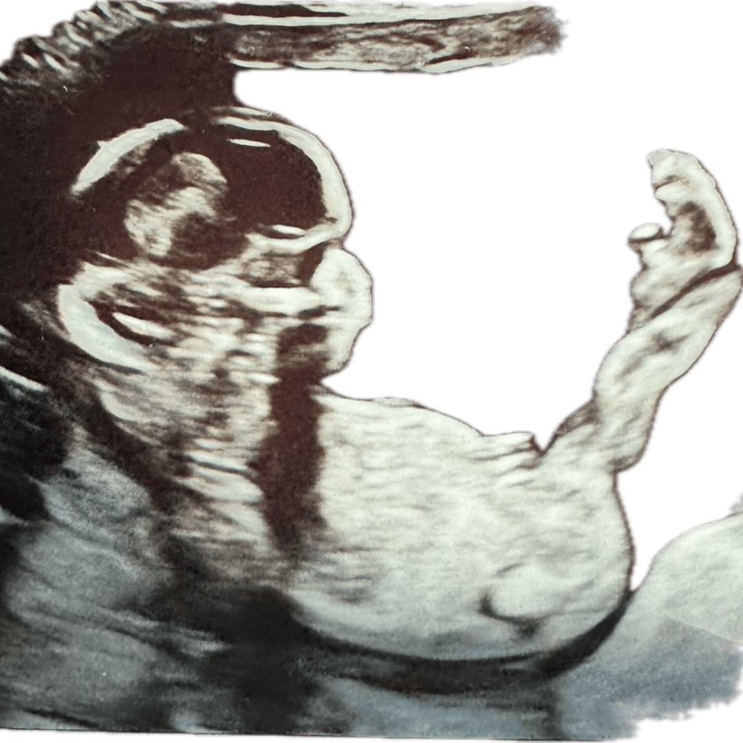 Photo shared by Emma for their Babylist baby registry.