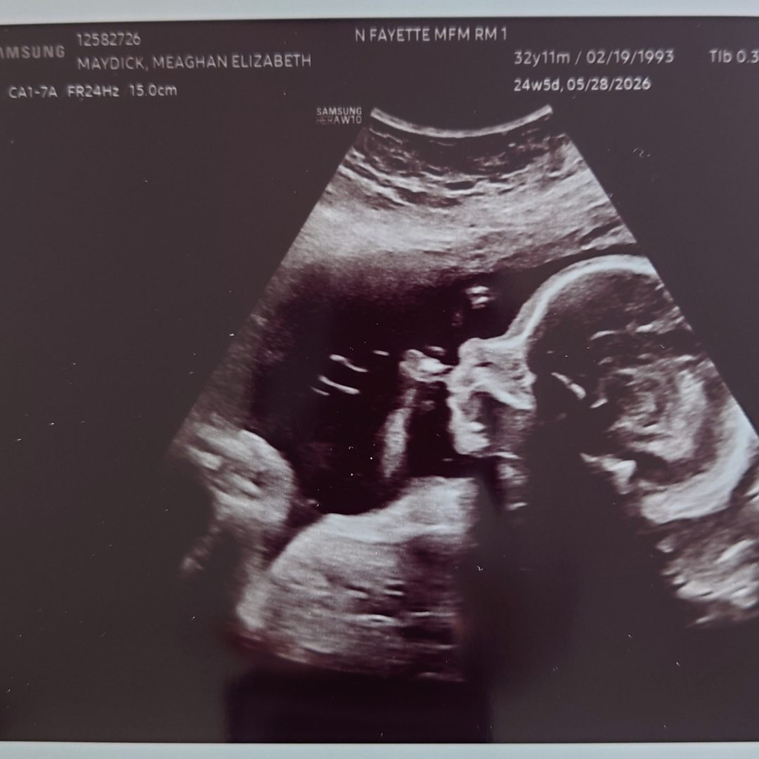 Photo shared by Meaghan for their Babylist baby registry.