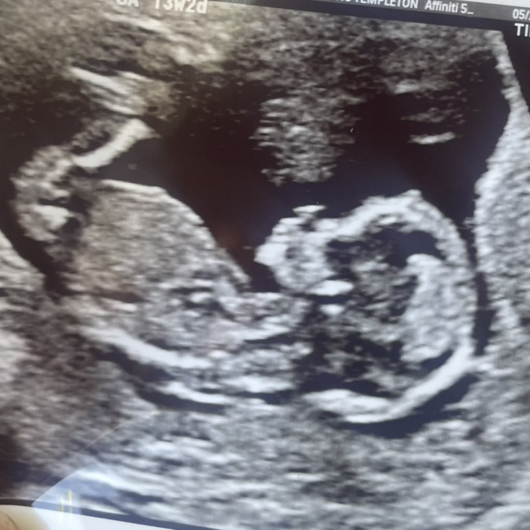 Photo shared by Amethyst for their Babylist baby registry.