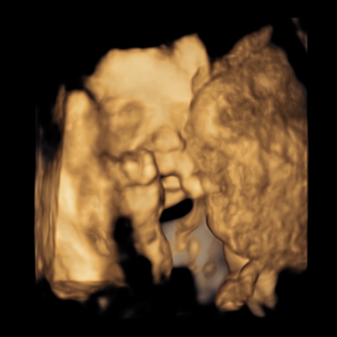 Photo shared by Ally for their Babylist baby registry.