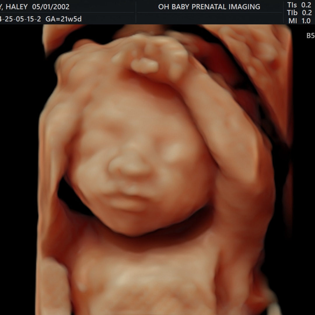 Photo shared by Haley for their Babylist baby registry.