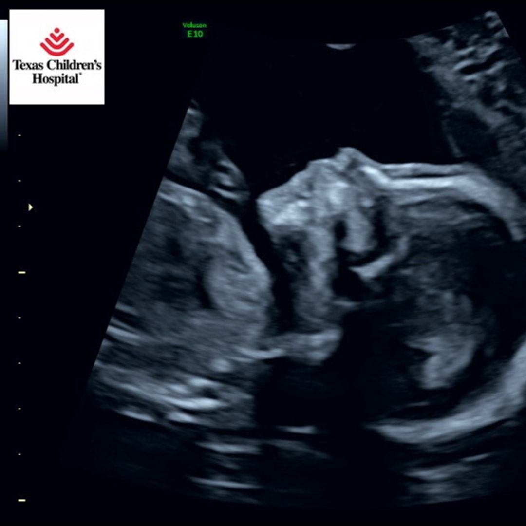 Photo shared by Alexis for their Babylist baby registry.