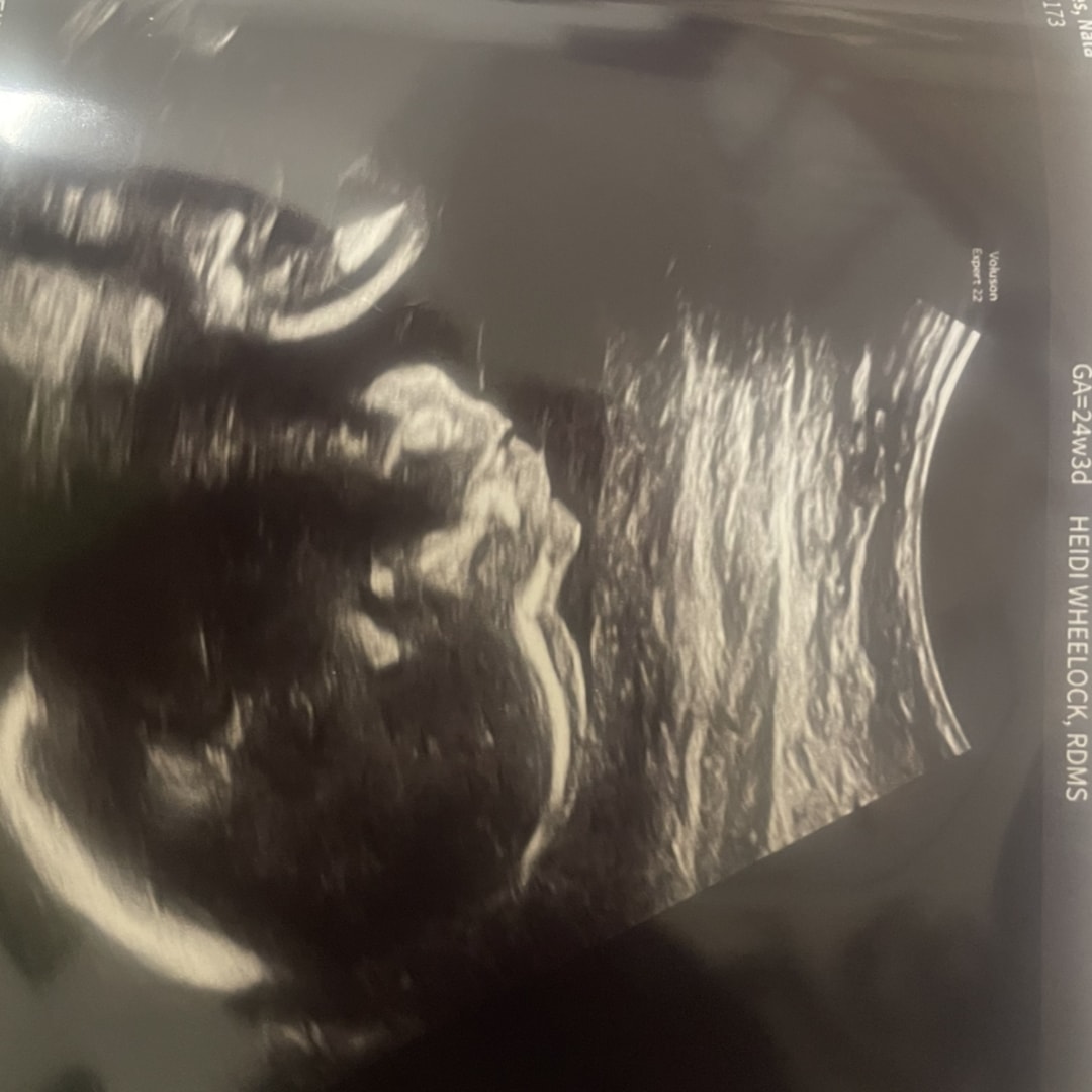 Photo shared by Nala for their Babylist baby registry.