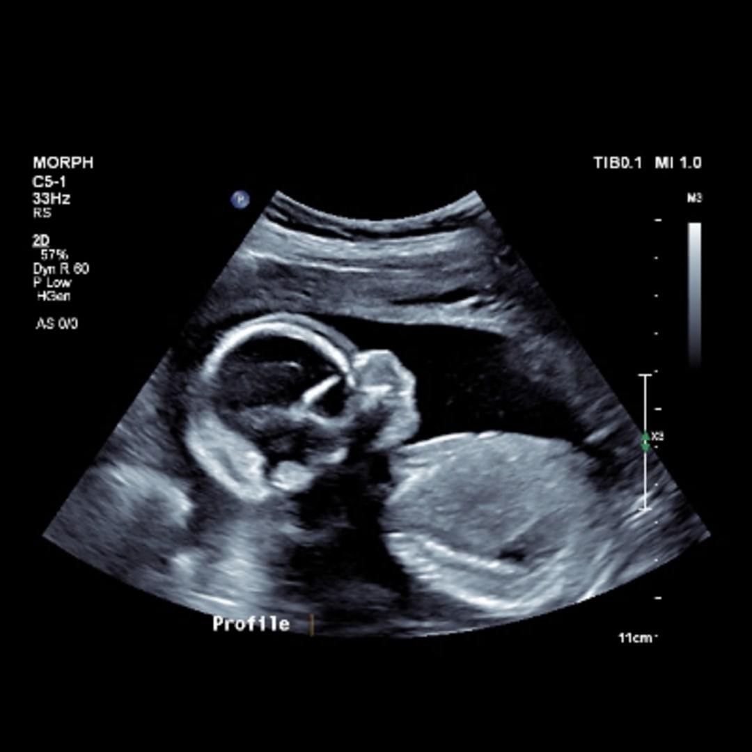 Photo shared by Araya for their Babylist baby registry.