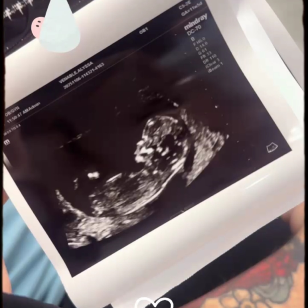 Photo shared by Alyssa for their Babylist baby registry.