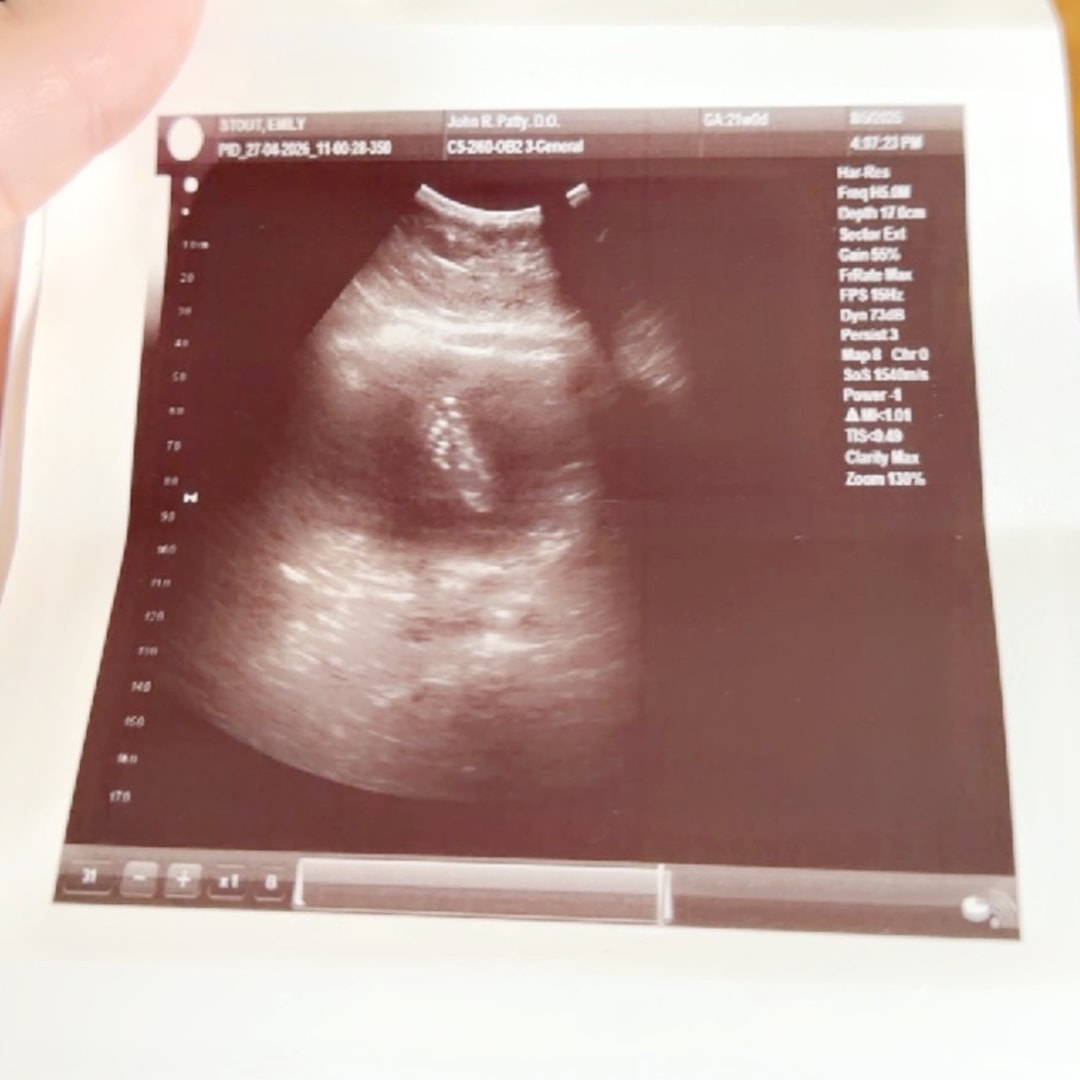 Photo shared by Emily for their Babylist baby registry.