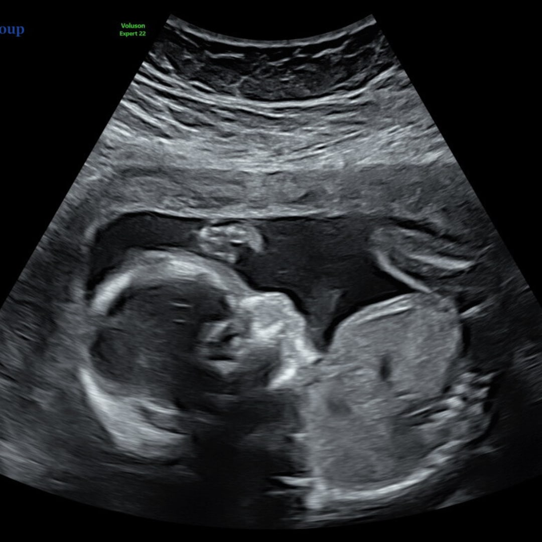 Photo shared by Alyssa for their Babylist baby registry.