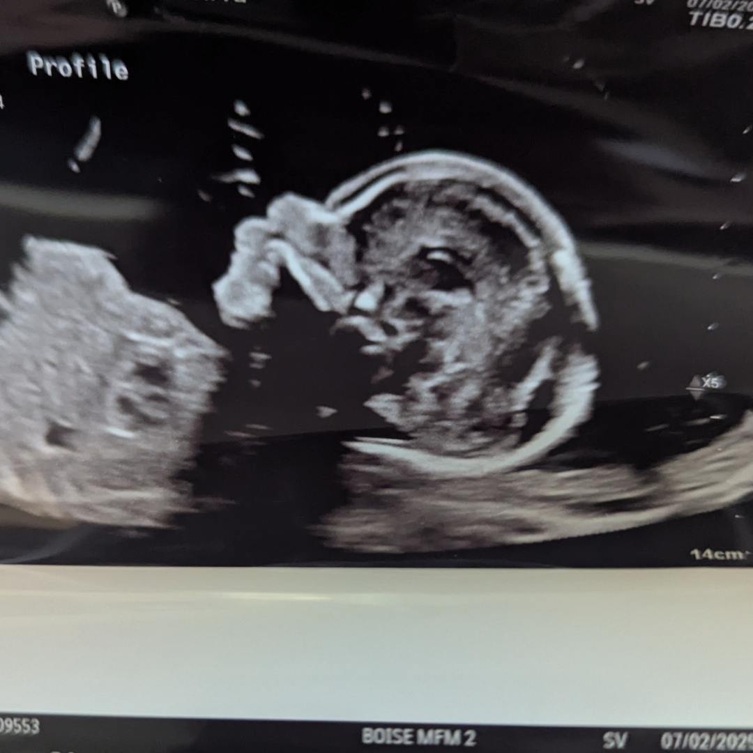 Photo shared by Terrie for their Babylist baby registry.