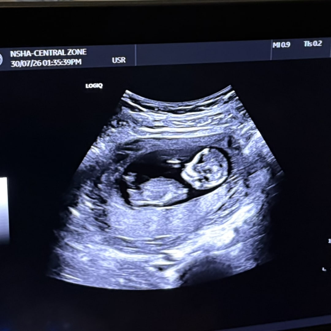 Photo shared by Ashley for their Babylist baby registry.