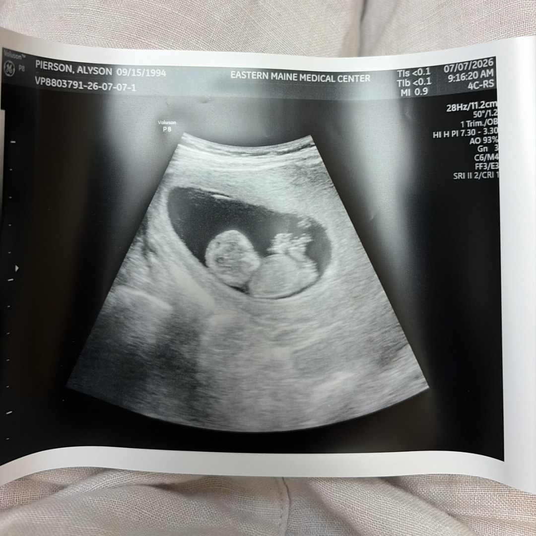 Photo shared by Alyson for their Babylist baby registry.