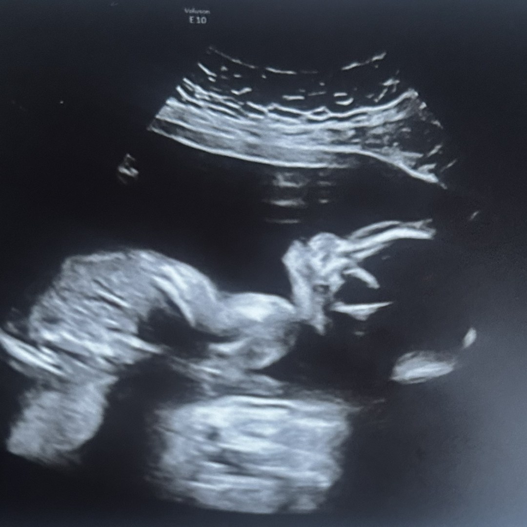 Photo shared by Anissa for their Babylist baby registry.