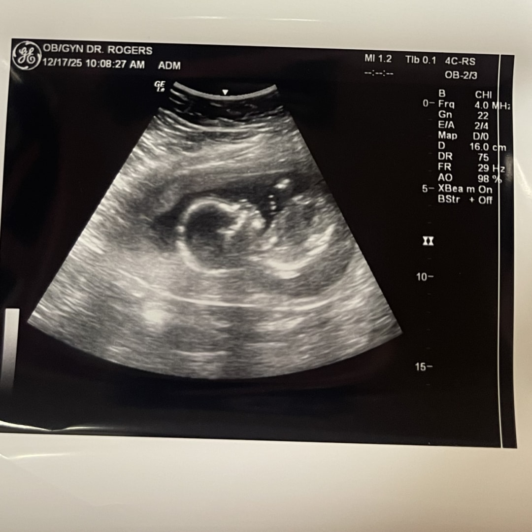 Photo shared by Karen for their Babylist baby registry.