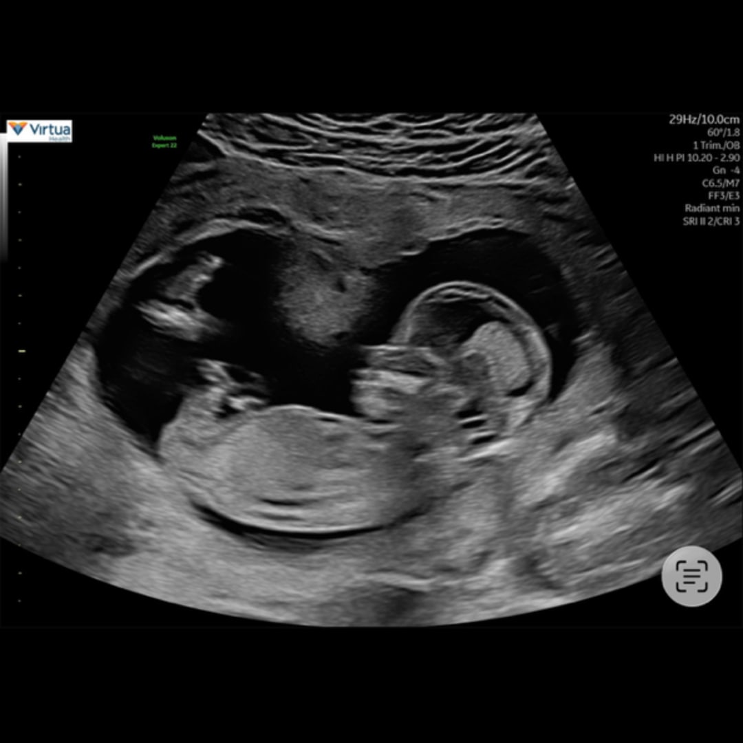 Photo shared by Yediza for their Babylist baby registry.