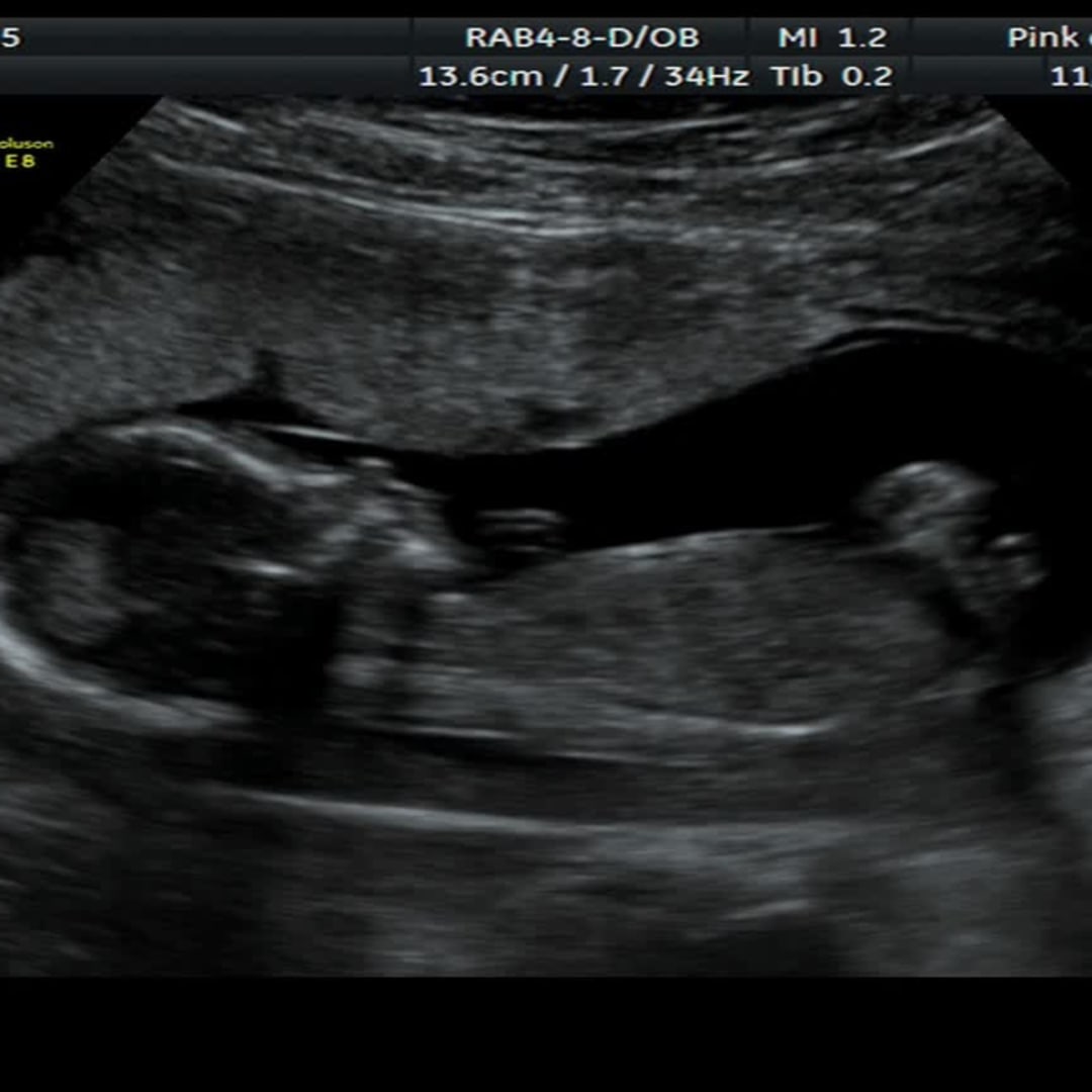 Photo shared by Destiny for their Babylist baby registry.