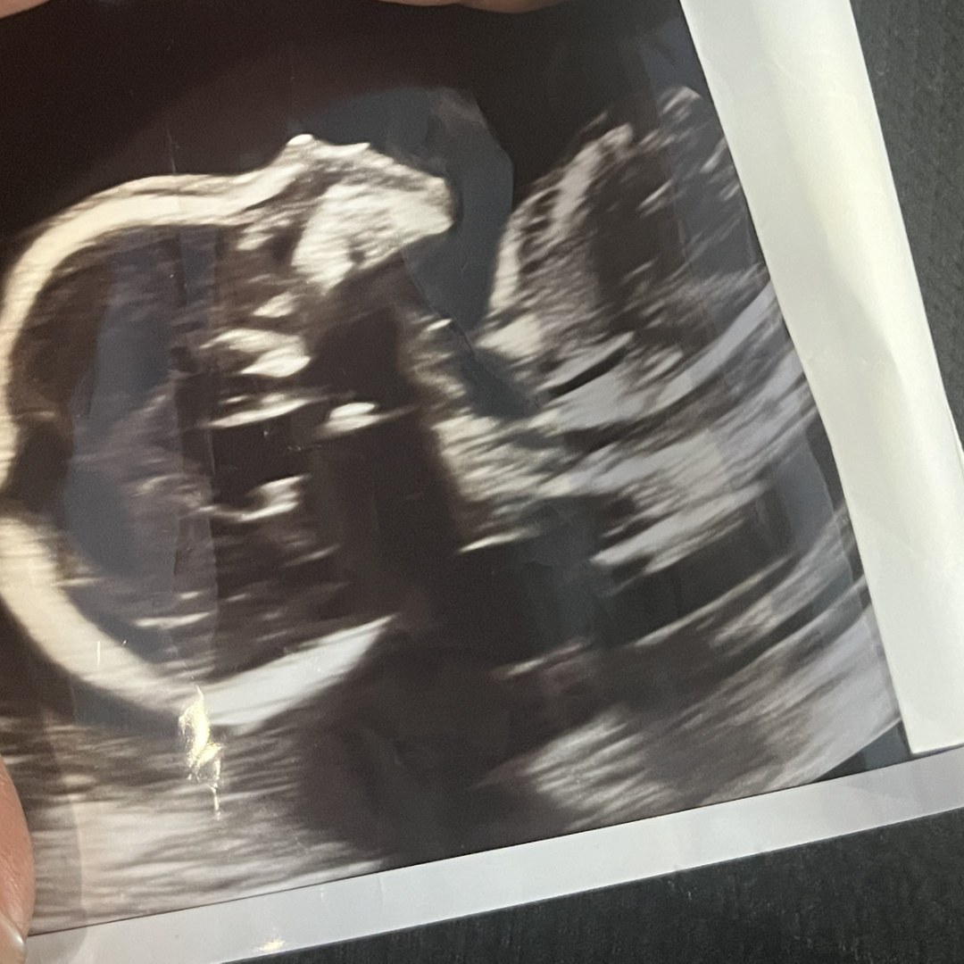 Photo shared by Ashley for their Babylist baby registry.