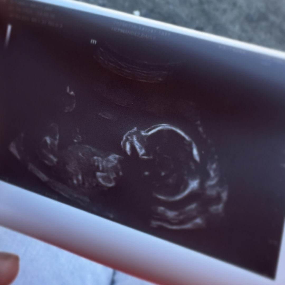 Photo shared by Daisy for their Babylist baby registry.