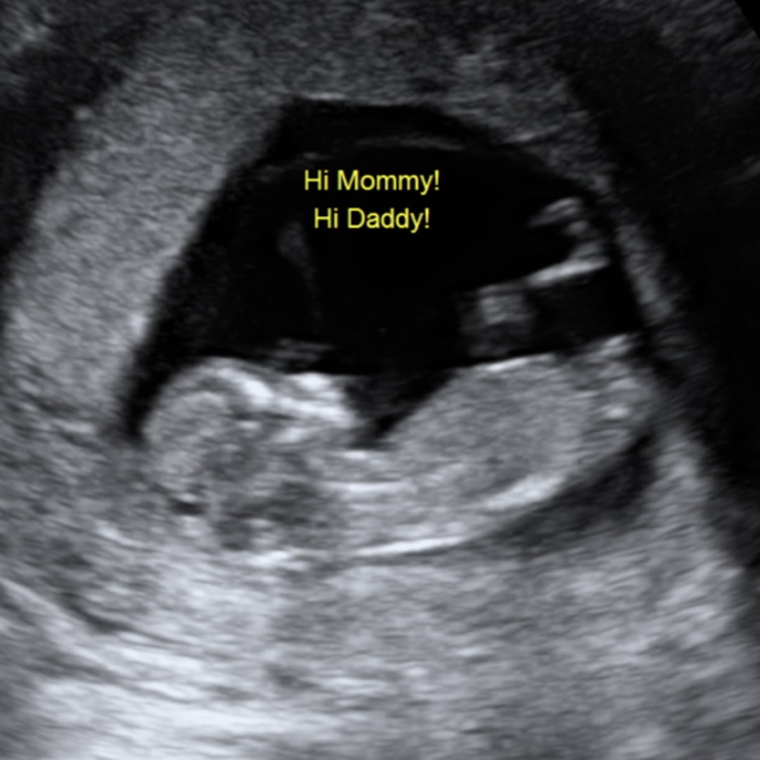 Photo shared by Haley for their Babylist baby registry.