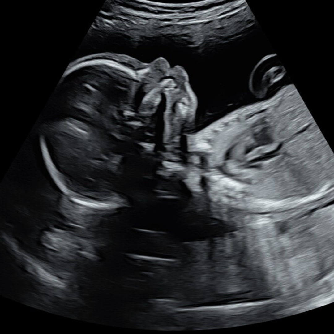 Photo shared by Ellis for their Babylist baby registry.