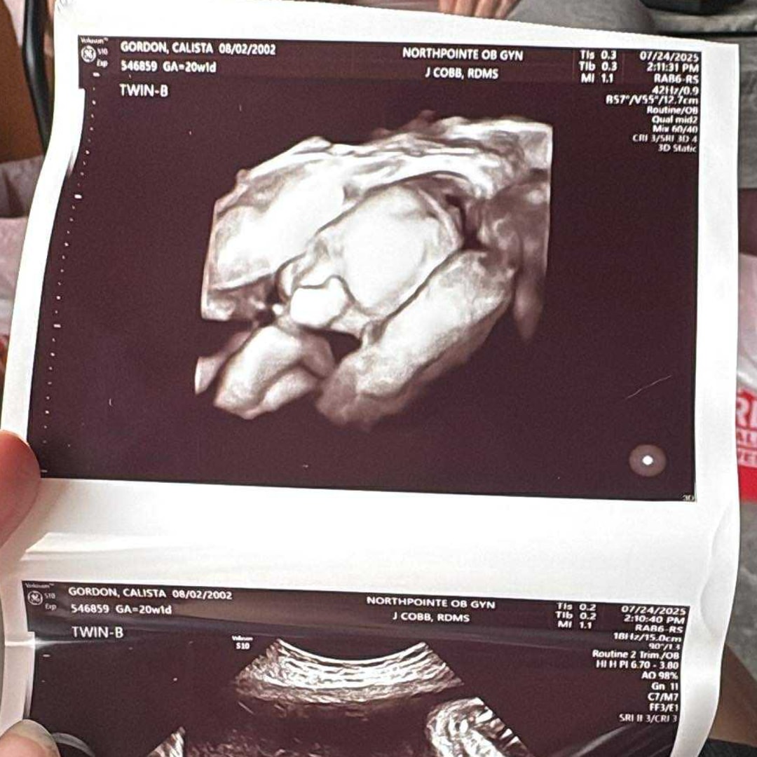 Photo shared by Calista for their Babylist baby registry.
