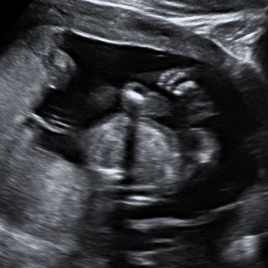 Photo shared by Sasha for their Babylist baby registry.