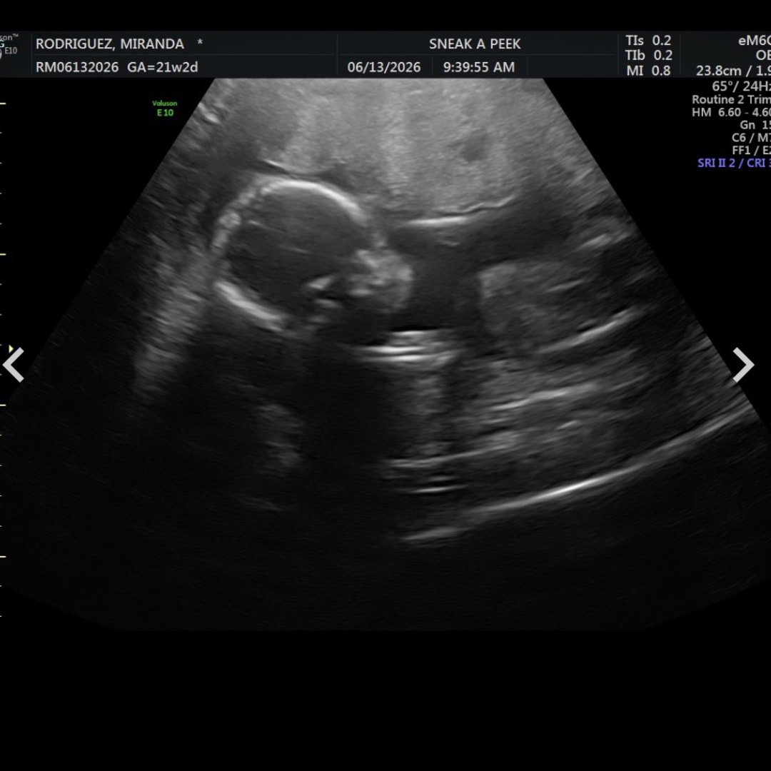 Photo shared by Catie for their Babylist baby registry.