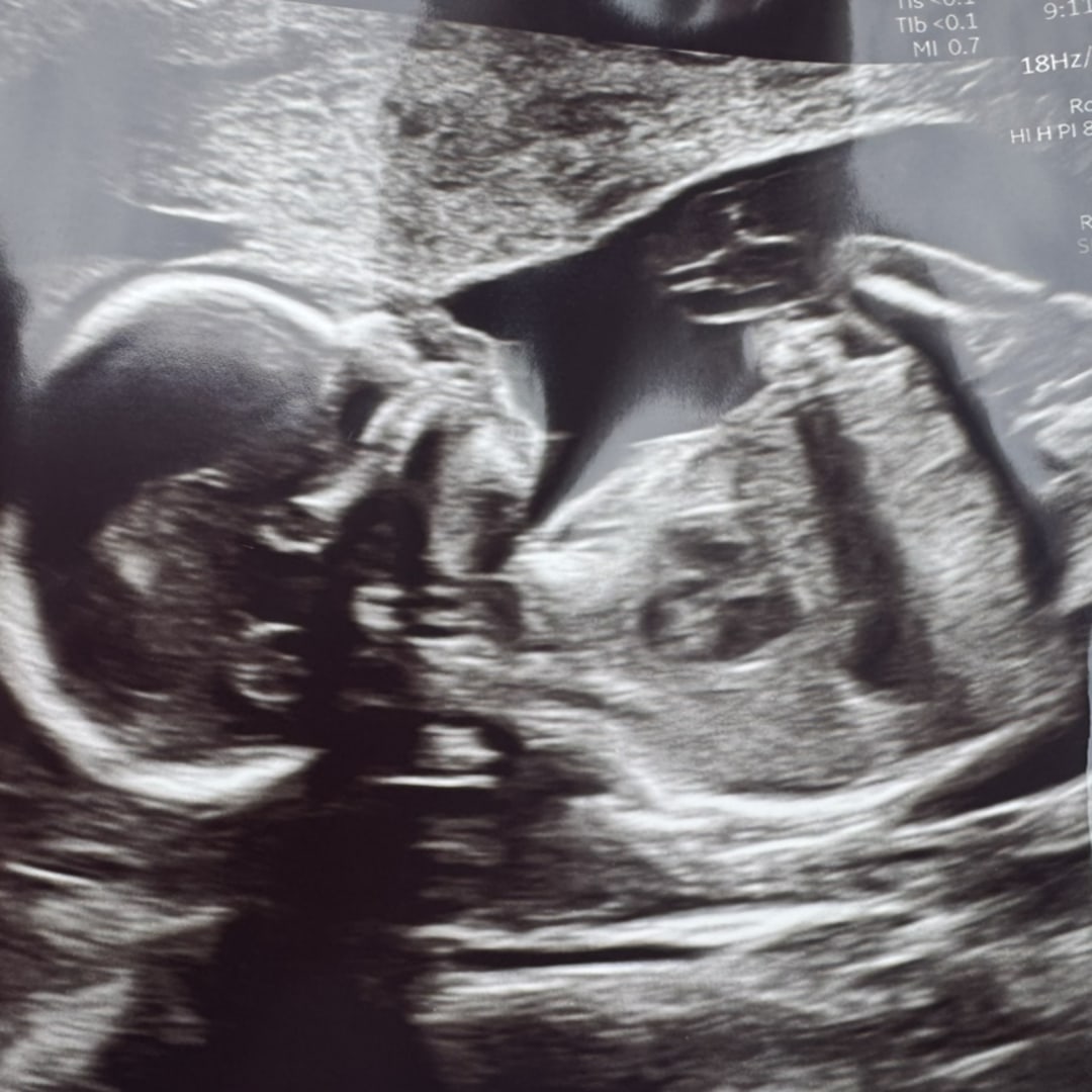 Photo shared by Jaclyn for their Babylist baby registry.