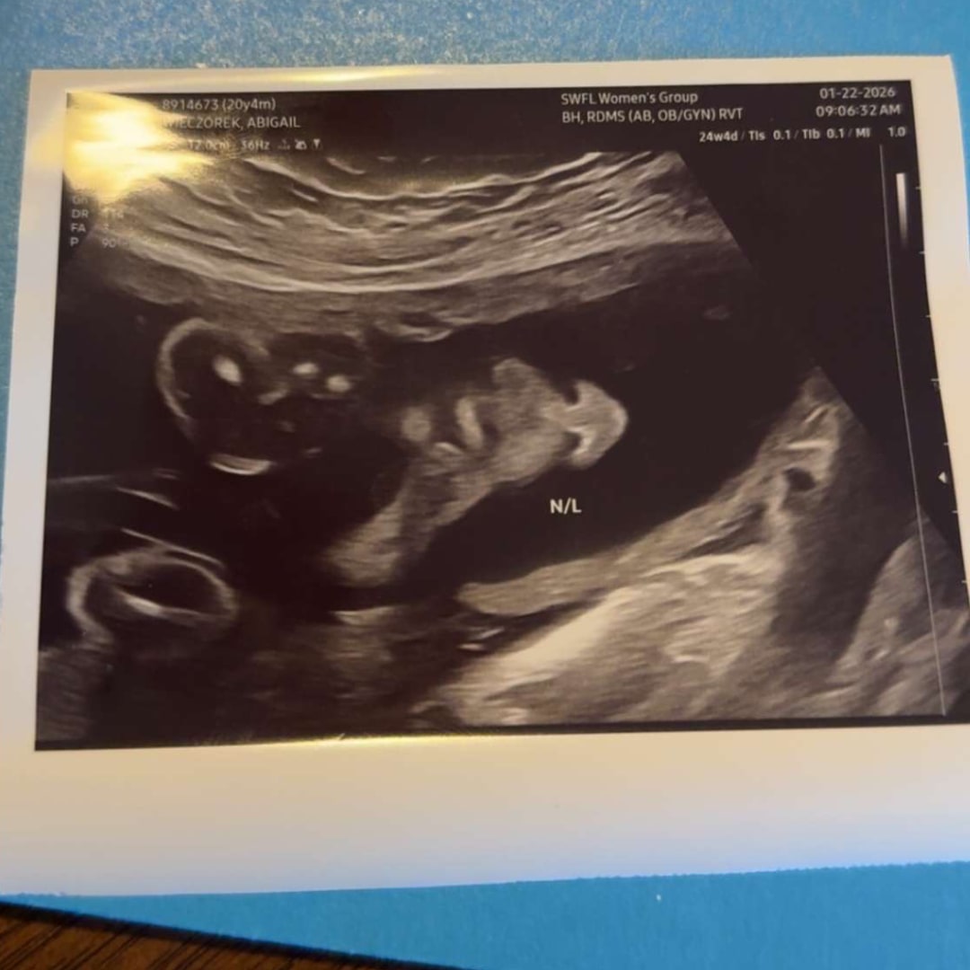 Photo shared by Abbi for their Babylist baby registry.