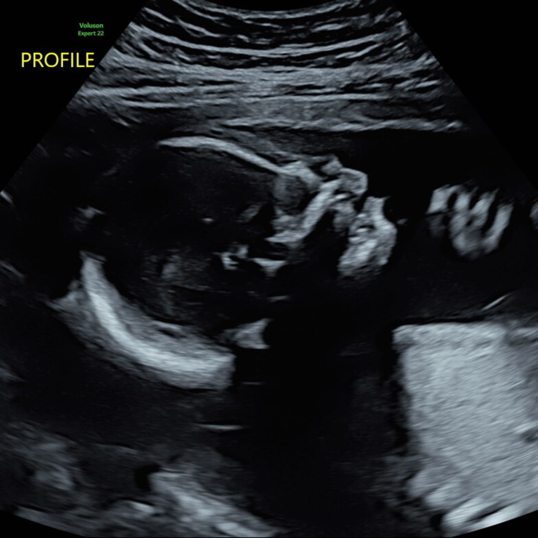 Photo shared by Ashley for their Babylist baby registry.