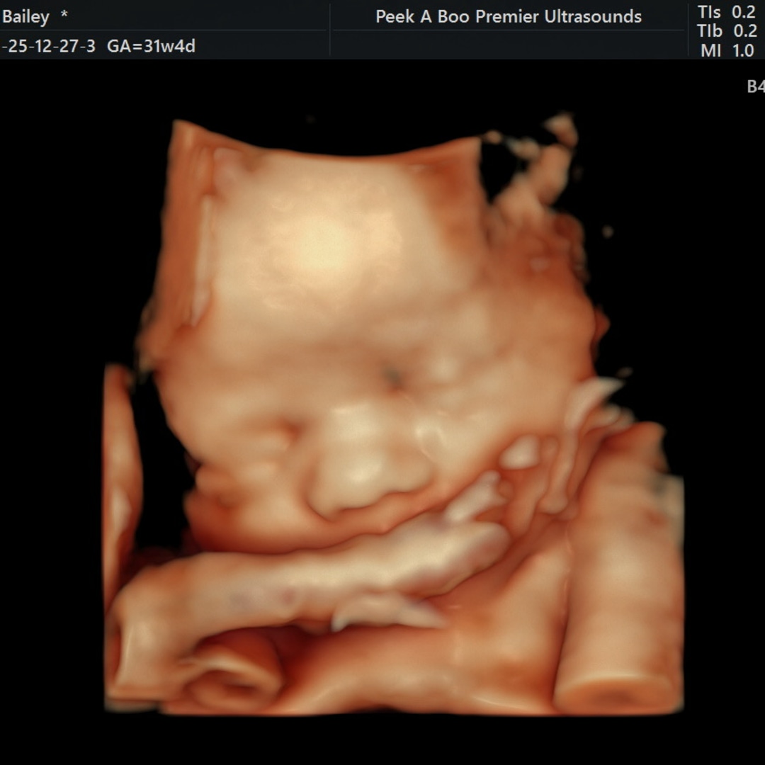 Photo shared by Bailey for their Babylist baby registry.