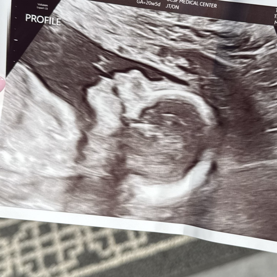 Photo shared by Carlotta for their Babylist baby registry.