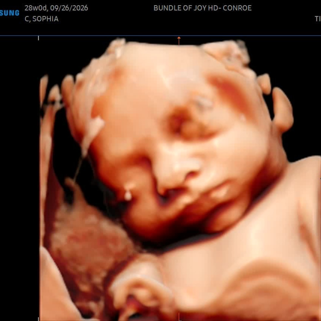 Photo shared by Sophia for their Babylist baby registry.