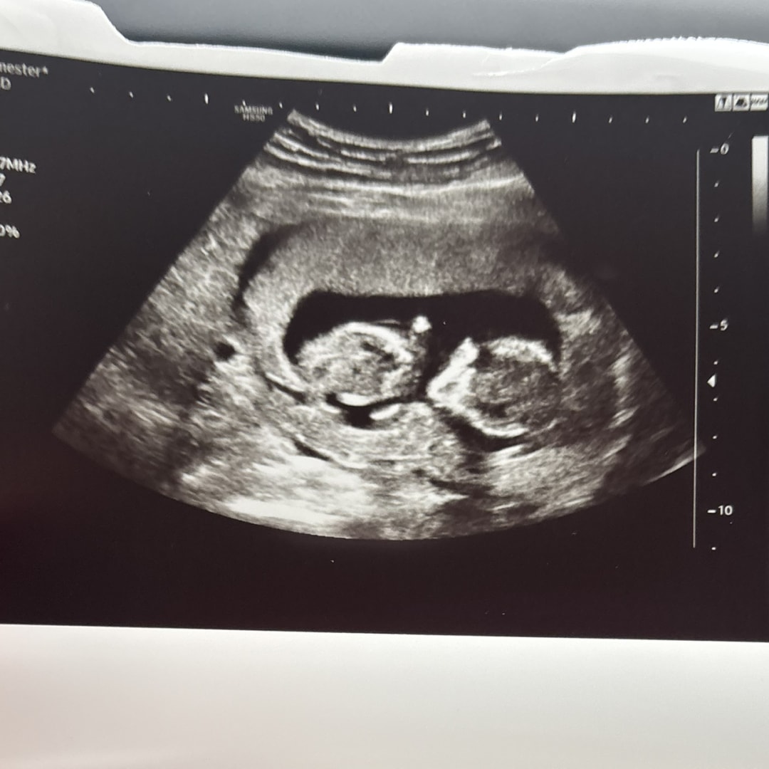 Photo shared by Stacey for their Babylist baby registry.