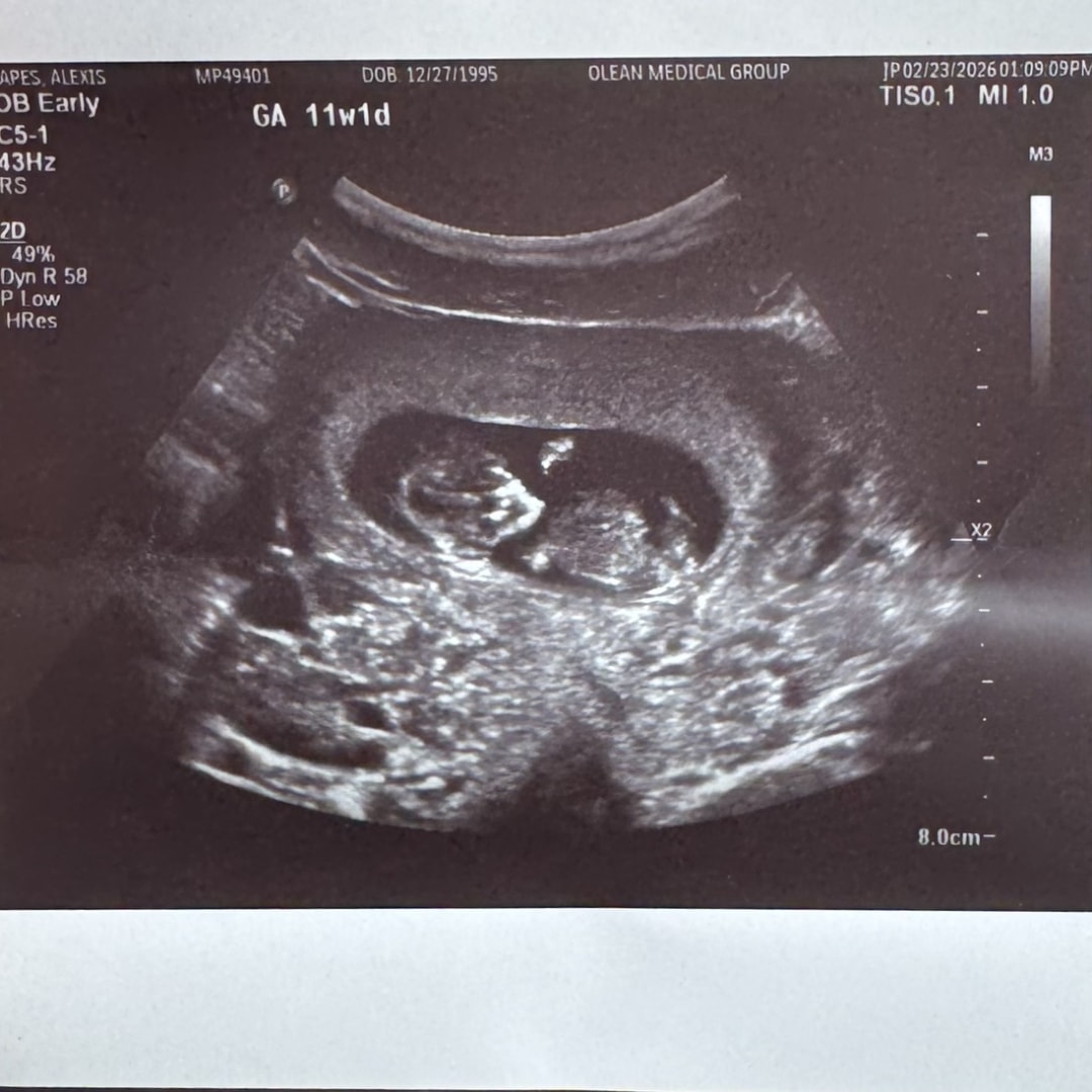 Photo shared by Alexis for their Babylist baby registry.