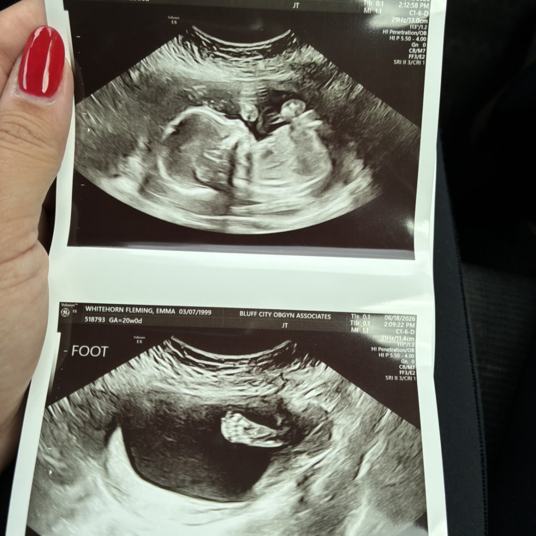 Photo shared by Emma for their Babylist baby registry.