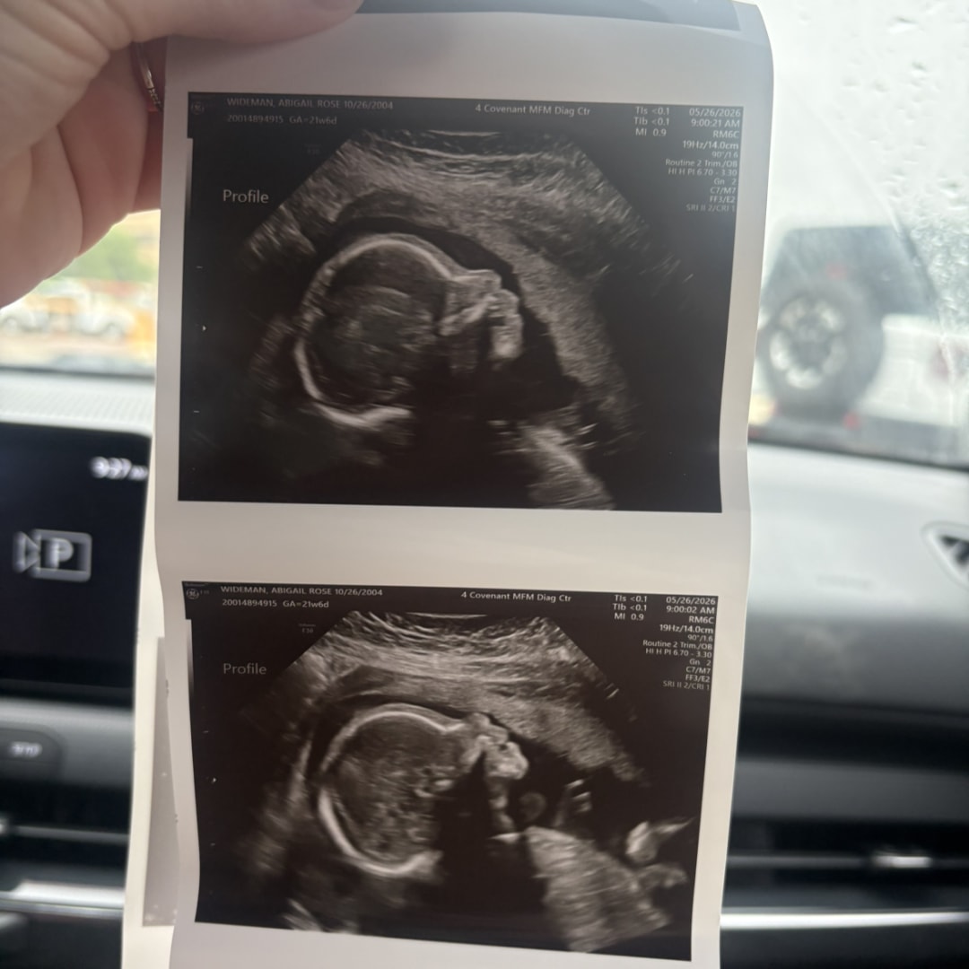 Photo shared by Abby for their Babylist baby registry.