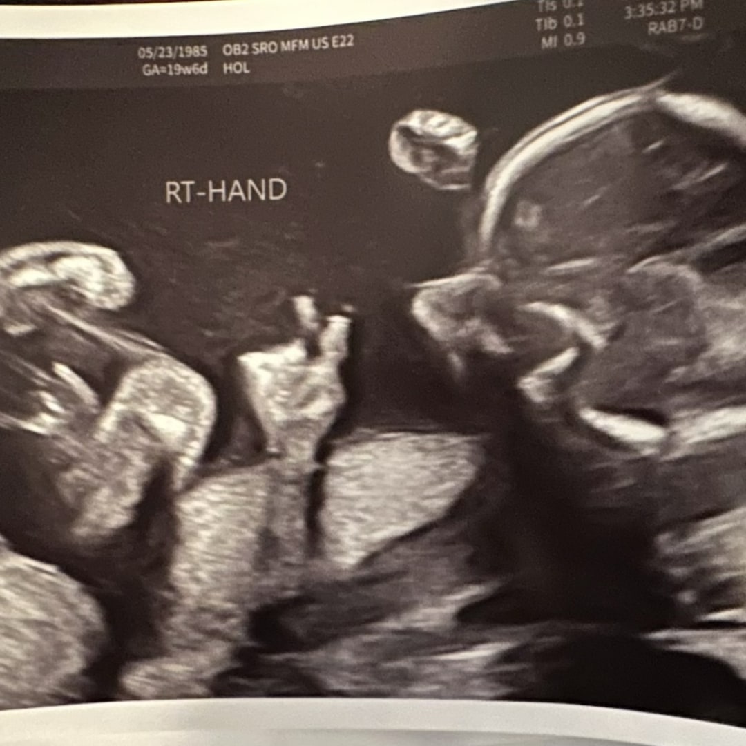 Photo shared by Gabrielle for their Babylist baby registry.